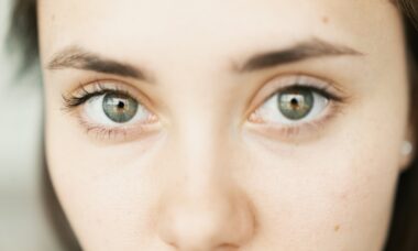 Photo "Quick and effective remedies for tired, puffy eyes and dark circles"