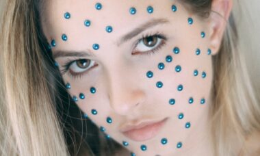 Photo "How to combat acne and blackheads: Treatments and prevention"
